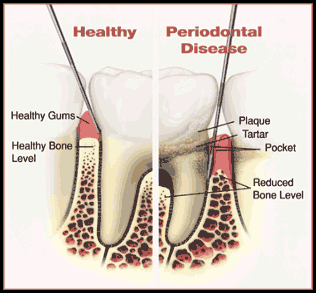 toothdiagram